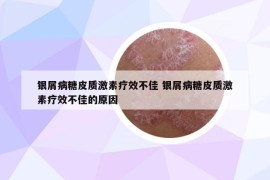 銀屑病糖皮質(zhì)激素療效不佳 銀屑病糖皮質(zhì)激素療效不佳的原因