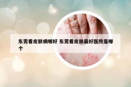 東莞看皮膚病哪好 東莞看皮膚最好醫(yī)院是哪個