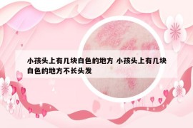 小孩頭上有幾塊白色的地方 小孩頭上有幾塊白色的地方不長頭發(fā)