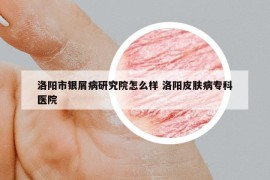 洛陽市銀屑病研究院怎么樣 洛陽皮膚病?？漆t(yī)院