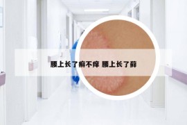 腰上長(zhǎng)了癬不癢 腰上長(zhǎng)了蘚