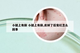 小腿上有蘚 小腿上有蘚,皮掉了后變紅怎么回事