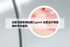 合肥治銀屑病選國(guó)人good 合肥治療銀屑病的專科醫(yī)院