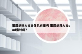 銀屑病擦大寶身體乳有用嗎 銀屑病用大寶sod蜜好嗎?