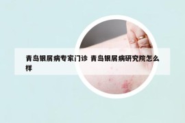 青島銀屑病專家門診 青島銀屑病研究院怎么樣