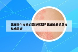 溫州治牛皮癬的醫(yī)院哪家好 溫州誰看銀屑皮膚病最好