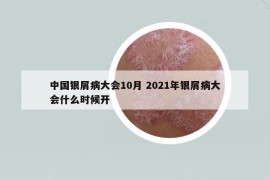 中國銀屑病大會10月 2021年銀屑病大會什么時候開