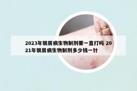 2023年銀屑病生物制劑要一直打嗎 2021年銀屑病生物制劑多少錢一針