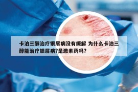 卡泊三醇治療銀屑病沒有緩解 為什么卡泊三醇能治療銀屑病?是激素藥嗎?