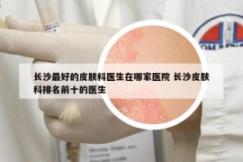 長沙最好的皮膚科醫(yī)生在哪家醫(yī)院 長沙皮膚科排名前十的醫(yī)生