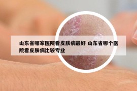 山東省哪家醫(yī)院看皮膚病最好 山東省哪個(gè)醫(yī)院看皮膚病比較專業(yè)