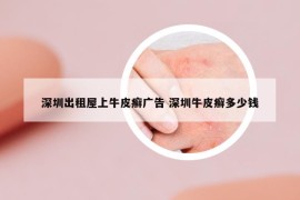 深圳出租屋上牛皮癬廣告 深圳牛皮癬多少錢
