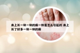 身上長一塊一塊的癬一樣是怎么引起的 身上長了好多一塊一塊的癬