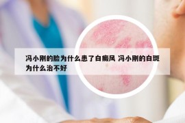 馮小剛的臉為什么患了白癜風(fēng) 馮小剛的白斑為什么治不好