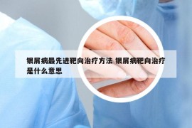 銀屑病最先進(jìn)靶向治療方法 銀屑病靶向治療是什么意思