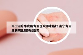 南寧治療牛皮癬專(zhuān)業(yè)醫(yī)院哪家最好 南寧專(zhuān)治皮膚病比較好的醫(yī)院