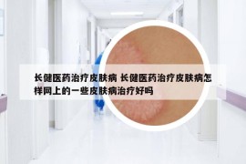 長健醫(yī)藥治療皮膚病 長健醫(yī)藥治療皮膚病怎樣網(wǎng)上的一些皮膚病治療好嗎