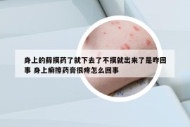 身上的蘚摸藥了就下去了不摸就出來了是咋回事 身上癬擦藥膏很疼怎么回事