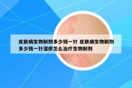皮膚病生物制劑多少錢(qián)一針 皮膚病生物制劑多少錢(qián)一針濕疹怎么治療生物制劑