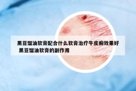 黑豆餾油軟膏配合什么軟膏治療牛皮癬效果好 黑豆餾油軟膏的副作用