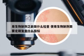 用生物制劑之前做什么檢查 使用生物制劑需要定期復(fù)查什么指標(biāo)