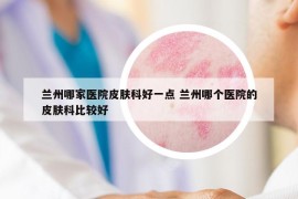 蘭州哪家醫(yī)院皮膚科好一點(diǎn) 蘭州哪個(gè)醫(yī)院的皮膚科比較好