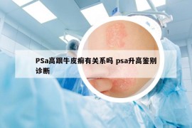 PSa高跟牛皮癬有關(guān)系嗎 psa升高鑒別診斷