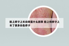 臉上脖子上長白斑是什么回事 臉上和脖子上長了很多白色疹子