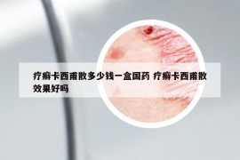療癬卡西甫散多少錢一盒國藥 療癬卡西甫散效果好嗎
