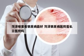 菏澤哪里看銀屑病最好 菏澤銀屑病醫(yī)院是私立醫(yī)院嗎