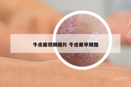 牛皮廨初期圖片 牛皮廨早期圖