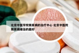 北京中醫(yī)學院銀屑病的治療中心 北京中醫(yī)院銀屑病誰治的最好
