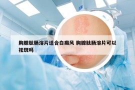 胸腺肽腸溶片適合白癜風(fēng) 胸腺肽腸溶片可以祛斑嗎