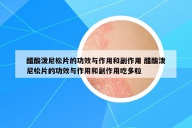 醋酸潑尼松片的功效與作用和副作用 醋酸潑尼松片的功效與作用和副作用吃多粒