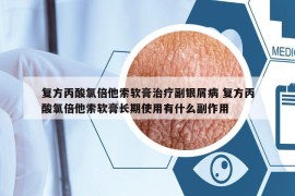 復(fù)方丙酸氯倍他索軟膏治療副銀屑病 復(fù)方丙酸氯倍他索軟膏長(zhǎng)期使用有什么副作用