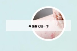 牛皮癬化驗一下