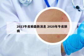 2023牛皮癬最新消息 2020年牛皮膚病