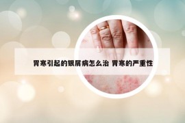 胃寒引起的銀屑病怎么治 胃寒的嚴(yán)重性
