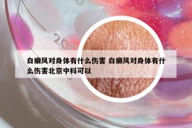 白癩風對身體有什么傷害 白癩風對身體有什么傷害北京中科可以