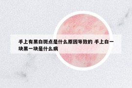 手上有黑白斑點是什么原因?qū)е碌?手上白一塊黑一塊是什么病