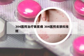304醫(yī)院治療銀屑病 304醫(yī)院皮膚科祛斑