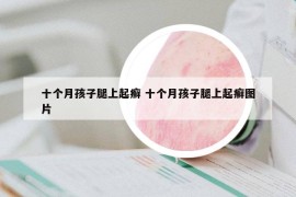 十個(gè)月孩子腿上起癬 十個(gè)月孩子腿上起癬圖片