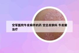 空軍醫(yī)院牛皮癬開的藥 空總皮膚科 牛皮廨治療