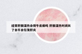 經(jīng)常肝膽濕熱會(huì)得牛皮癬嗎 肝膽濕熱時(shí)間長(zhǎng)了會(huì)不會(huì)引發(fā)肝炎