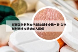 鄭州生物制劑治療皮膚病i多少錢一針 生物制劑治療皮膚病納入醫(yī)保