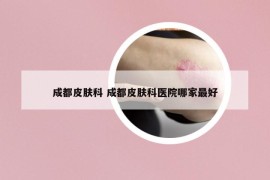成都皮膚科 成都皮膚科醫(yī)院哪家最好