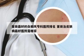 莆田最好的白癜風(fēng)?？漆t(yī)院排名 莆田治皮膚病最好醫(yī)院是哪家