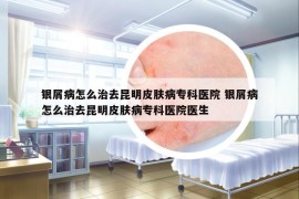 銀屑病怎么治去昆明皮膚病專科醫(yī)院 銀屑病怎么治去昆明皮膚病?？漆t(yī)院醫(yī)生