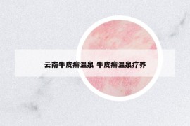 云南牛皮癬溫泉 牛皮癬溫泉療養(yǎng)