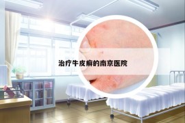 治療牛皮癬的南京醫(yī)院